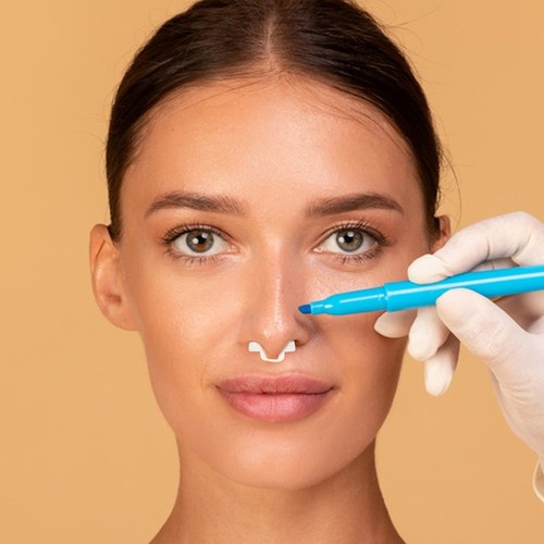 Soporte de fosa nasal guardián apoyo de nariz hombre Miss retenedor nasal rinoplastia - Imagen 9 de 12