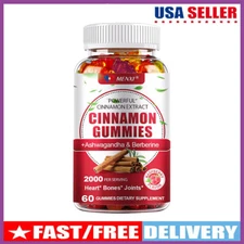 2000mg Cinnamon & Berberine Gummies - Insulin Sensitivity & Carb Blocker 60pcs