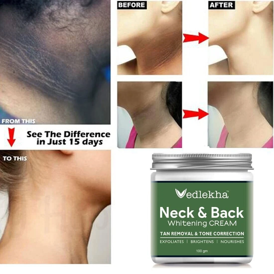Dark Neck Back Skin Whitening Lightening Cream Exfoliates Dead