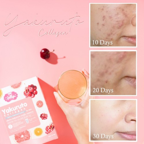 3X Yakuruto Yogurt Collagen Clear Skin Reduce Acne Bounce Face Juicy Fluffy - Picture 4 of 11