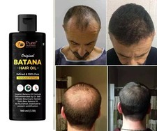 100 Organic. Batana Oil from Honduras natural hair growth 3.4 fl.oz/100ml