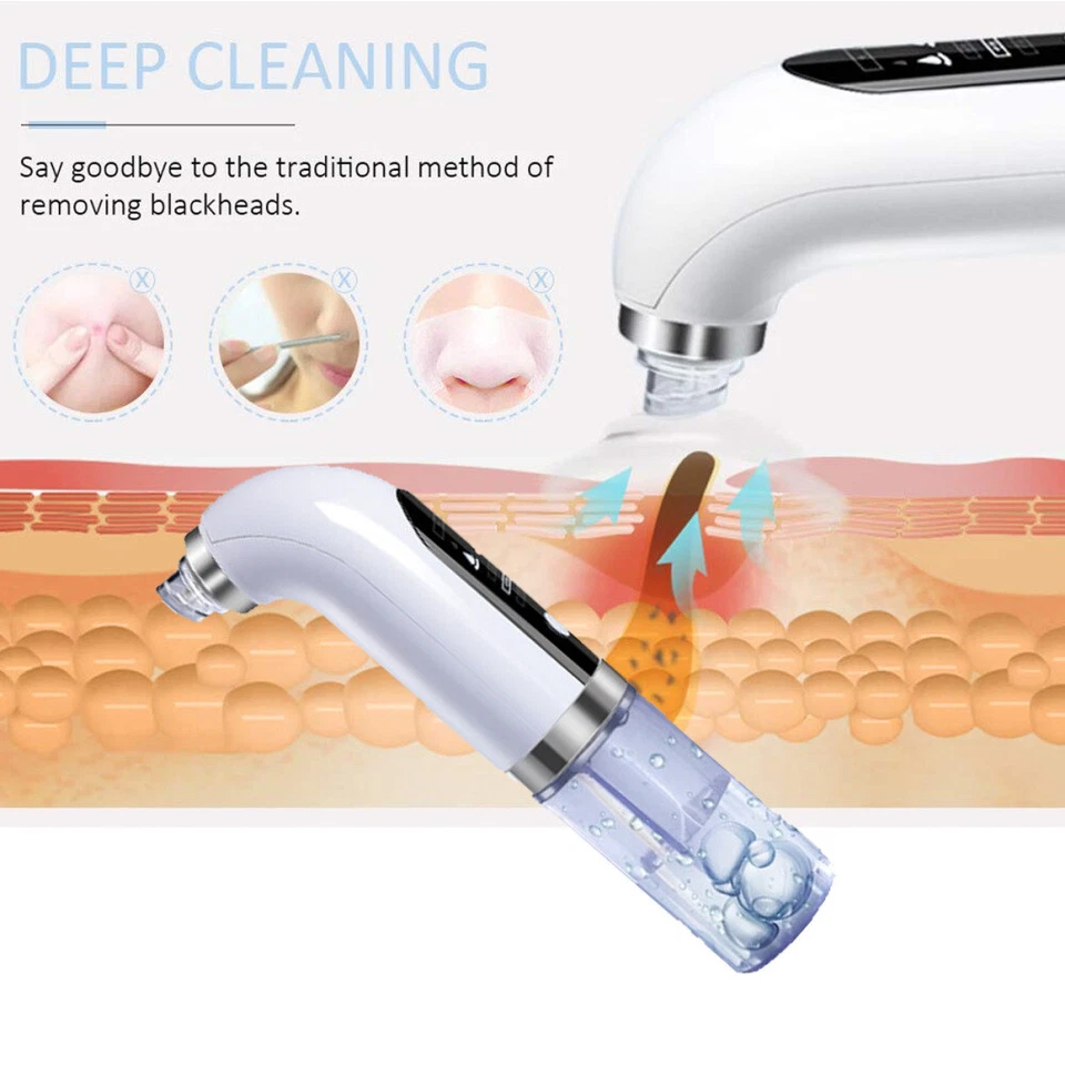 Electric Blackhead Remover Pore Cleaner Skin Face Machine Vacuum Facial Acne Dot - Image 2 of 4