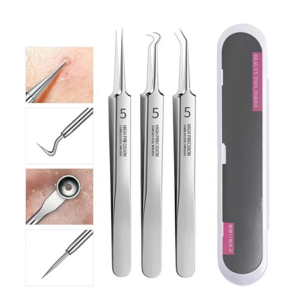 & Closing Facial Care Blackhead Tweezers Acne Needle Cell Clip Pimple  Remover | eBay