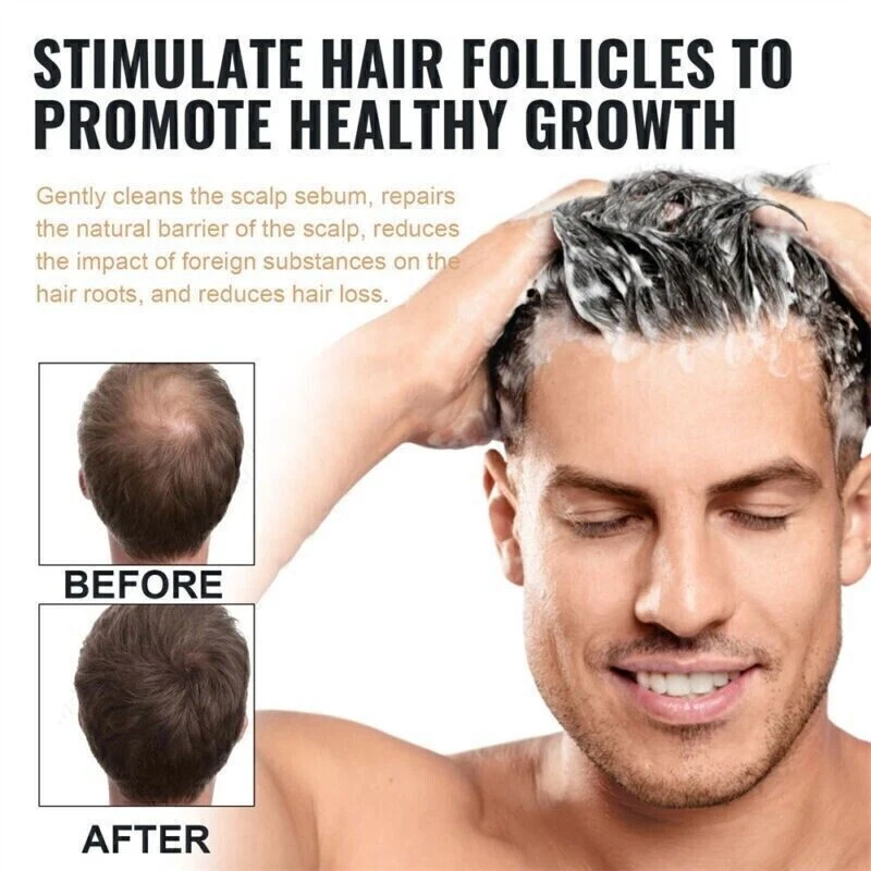 1-5x Shampoo,Root Activator Shampoo,Natural Hair Regrōwth Shampoos - Image 4 of 4