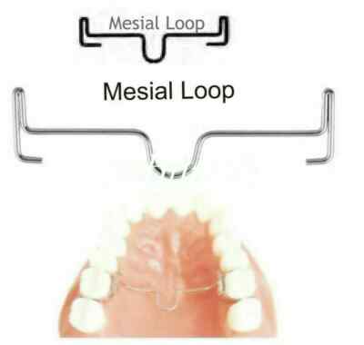 10Pcs/Set Orthodontic Dental Different Length Palatal Arch Bar Distal/Mesia Loop