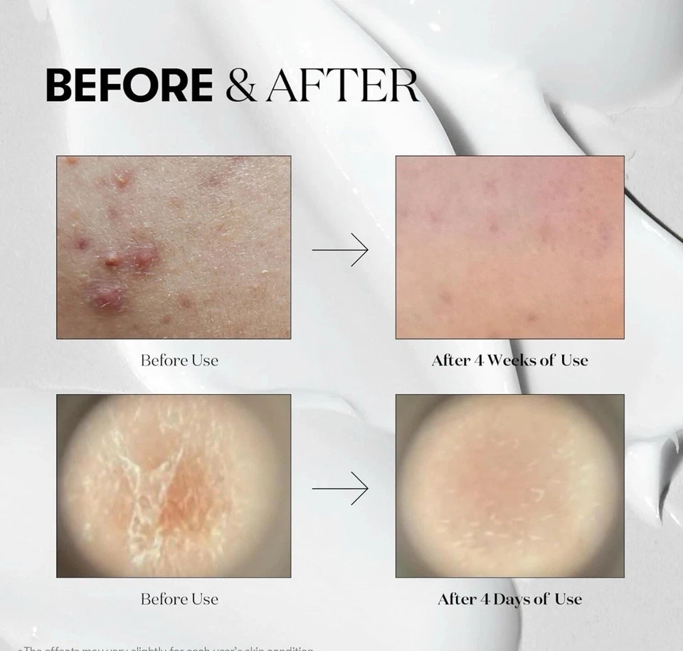 VT Cosmetics CICA REEDLE SHOT 700 Suero Tratamiento Manchas Microneedling, 1 oz / 30 ml Foto 3 de 4