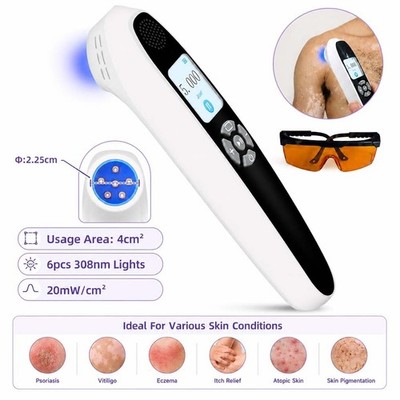308nm UVB Lamp Phototherapy Device for Small Skin Spots, Easy Carry, LCD Screen