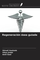 Shivali Vashisht (U. A.) | RegeneracióN óSea Guiada | Taschenbuch | Spanisch