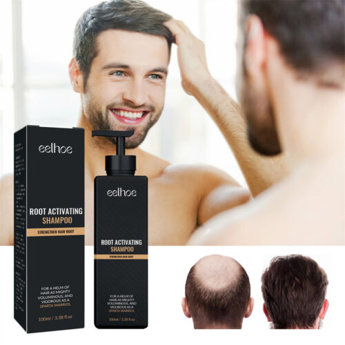 2X Spartan Root Activator Shampoo, Natural Hair Regrōwth Hair Loss Shampoos Neu - Bild 3 von 10