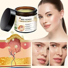 Bee Venom Skin Tag Removal Treatment Cream Body Care Mole Corn Wart Remover 