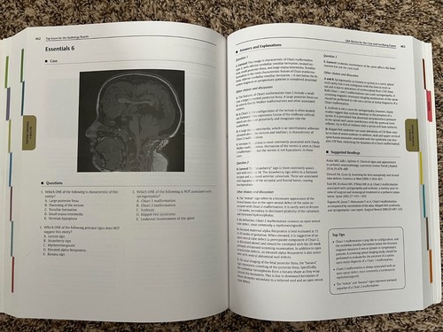Top Score for the Radiology Boards : Q&a for the Core and Certifying Exams by... - Imagen 3 de 3