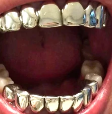 Silver Electroplated Non Tarnish Custom 8 Upper 8 Lower Grillz for Teeth + Molds