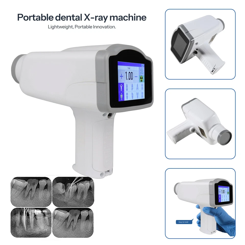 Dental Imaging System Portable Digital X-Ray Machine Handheld Xray Equipment S1 - Image 4 of 4