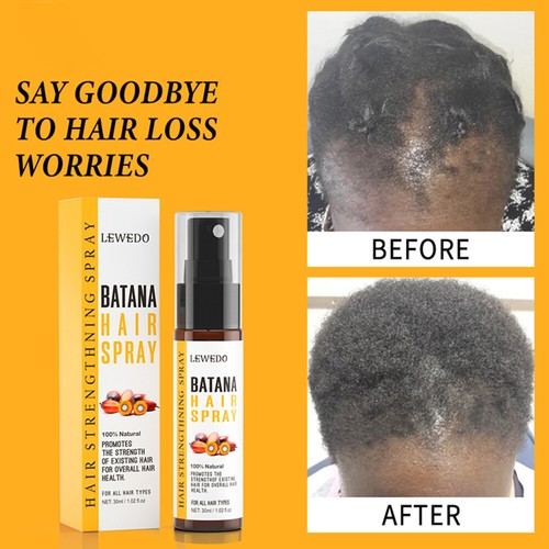Natural Batana Oil Serum for Hair Growth Healthier Thicker Repair Damaged Hair - Picture 26 of 34
