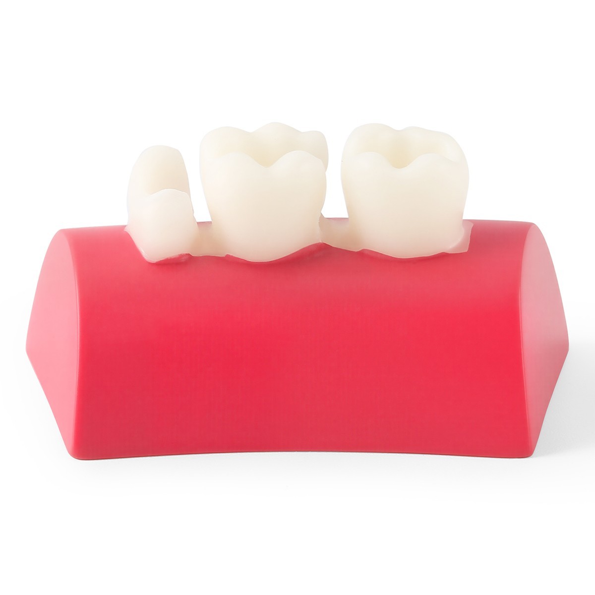 Portable Dental Mobile Digital X Ray Machine High Frequency+Non Shield/Sensor