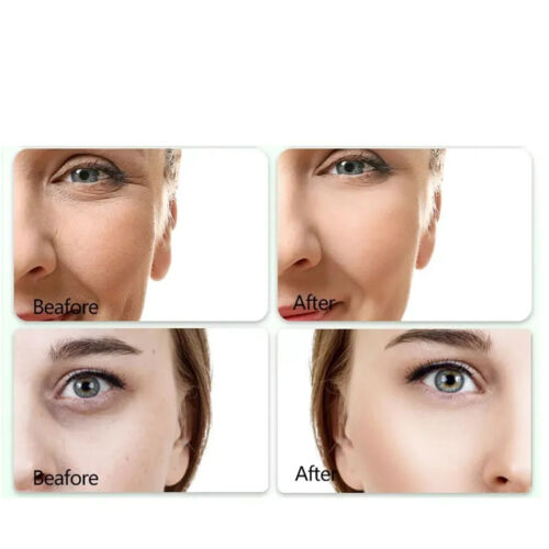 Instant Ageless 20 Fläschchen Facelift & Faltenentferner in Sekunden - Bild 11 von 18