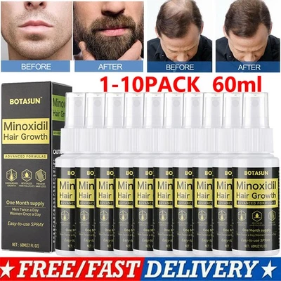 BOTASUN Minoxidil 5% Haarwachstum Extra Stärke Haarausfall Behandlung für Männer Lösung