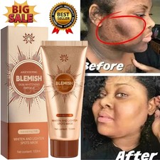 Spots Peel-Off Facial Mask Anti-Blemish Freckle Brightening Mask Deeply Clean UK