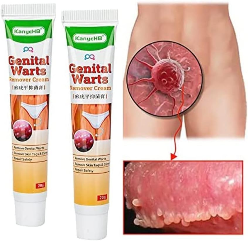 Crème Traitante Pour Herpès Génital Et Verrues - Acuminatum 20g - Neuf