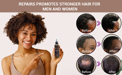 Caffeine Hair Growth Oil 2oz, Herbs, Biotin, Essential oils For All Hair Types - Picture 9 of 12