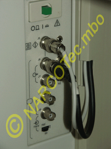 SIEMENS Sonoline SI 250 - Bild 6 von 12