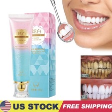 Niacinamide Whitening Toothpaste,Natural Niacinamide Toothpaste,Teeth Whitening
