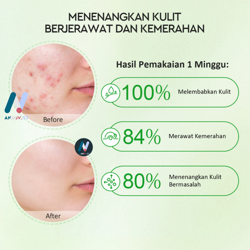 Glad2glow Centella Allantoin Soothing Gel Moisturizer Acne Calming Redness 55gr - Picture 20 of 22