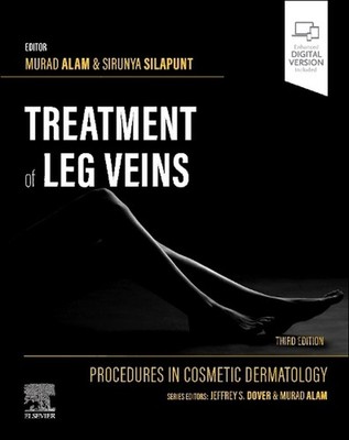 Procedures in Cosmetic Dermatology Series: Treatment of Leg Veins by Murad Alam 