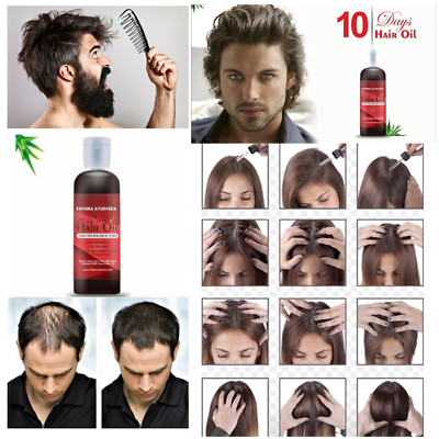 10 Days Hair Oil Powerful Plus Controls Hair Loss In 3 Days New Hair Growth Ebay