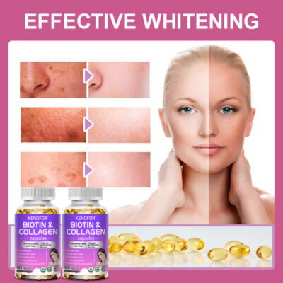 can glutathione cause hair loss Biotin Collagen & L-Glutathione- Anti-Aging,Hair Growth,Skin Health,Strong  Nails