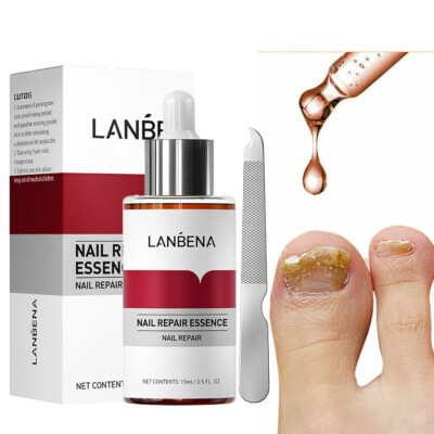 2.LANBENA Nail Repair Essence Remove Onychomycosis Serum Fungal Treatment Toe
