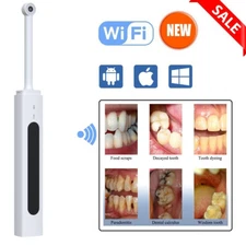 Wifi Dental Intraoral Camera Intra Oral Imaging Unit