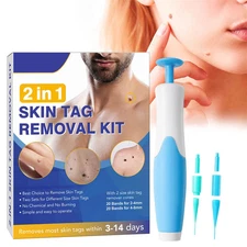 Skin Tag Removal Mole Wart Removal Facial Mole Wart Microstrip Tag Removal Kit
