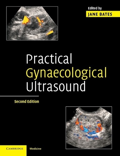 Practical Gynaecological Ultrasound by Jane Bates - 9780521674508