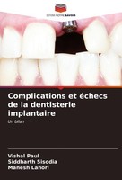 Complications Et éChecs De La Dentisterie Implantaire Siddharth Sisodia