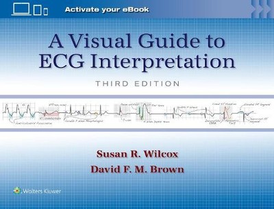 A Visual Guide to ECG Interpretation: Print + ---- with Mult... - 9781975213589