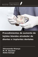 Procedimientos De Aumento De Tejidos Blandos Alrededor De Dientes E Implantes De