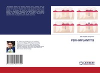 Amit Kumar Upadhyay | PERI-IMPLANTITIS | Taschenbuch | Englisch (2020)