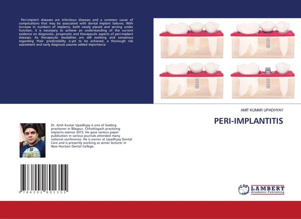 Amit Kumar Upadhyay | PERI-IMPLANTITIS | Taschenbuch | Englisch (2020)-image