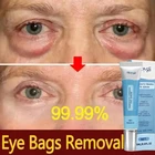 Under Eye Cream Remove Dark Circles Bags Face Lines Ageless Wrinkles Puffy Eye