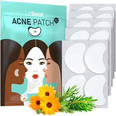 Acne Patches Large, Hydrocolloid Pimple Patches for Large Breakouts, Zit