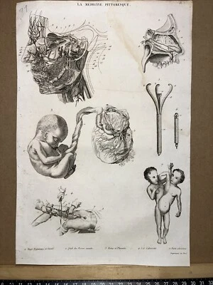 Antiquarische Stahlstich 1834 Anatomie Medizine Chirurgie Arzt Doktor Botanik - Bild 1 von 4