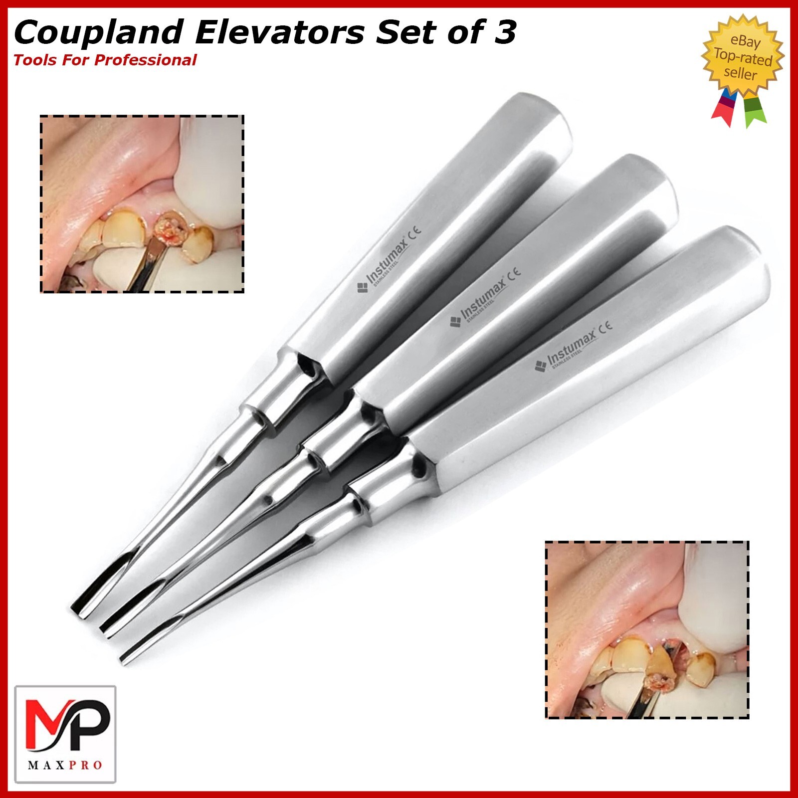 Understanding The Role Of Surgical Elevators In Complex Tooth - Foto 3