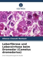 Allaoua Chaouki Bentazir | Leberfibrose und L...