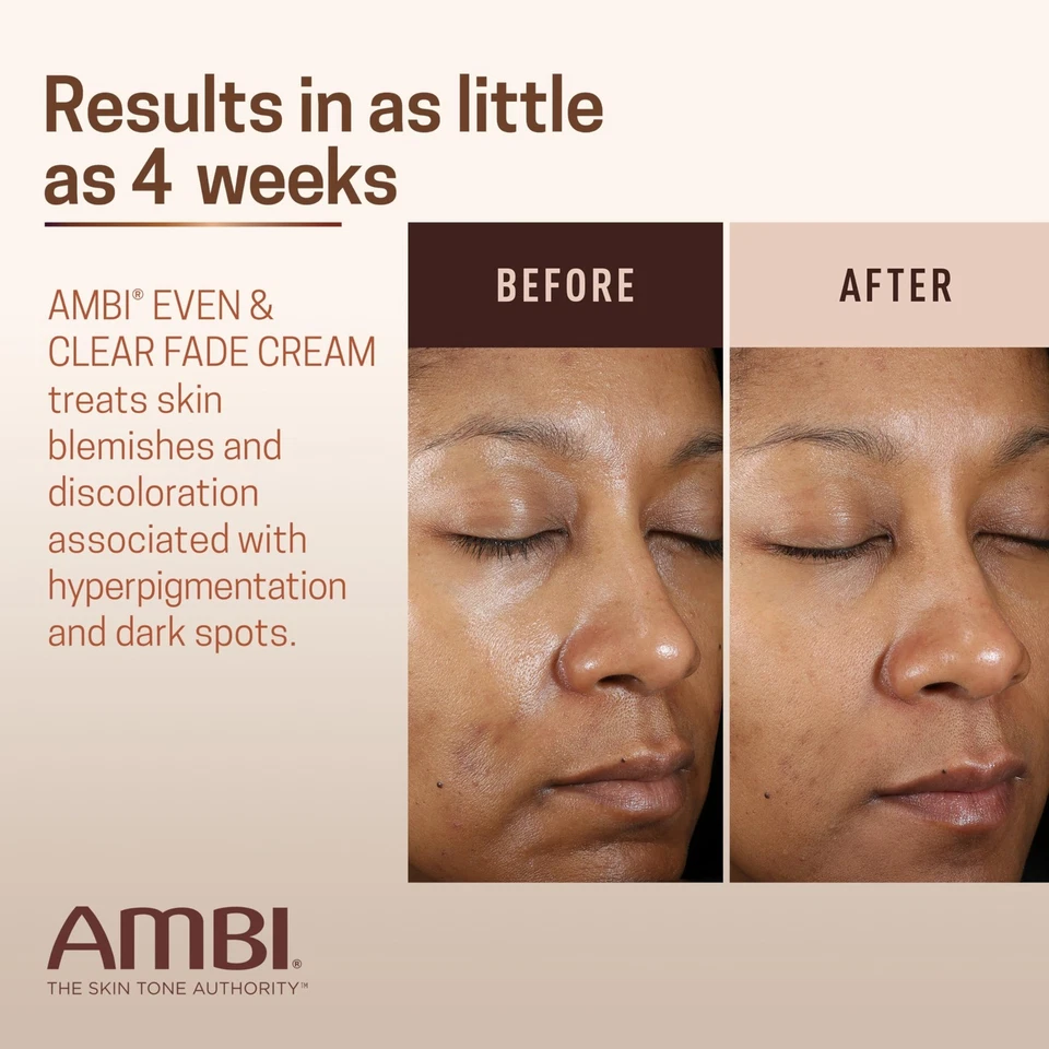 AMBI Skin Dark spot Fade cream Lightening Bleaching Cream Dark Spot Whitening - Image 4 of 4