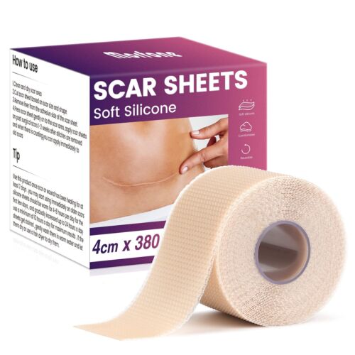 "Hojas para cicatrices de silicona (1,6"" x 150"" rollo-3,8M), cinta para cicatrices de silicona morfona, pro... - Imagen 1 de 7