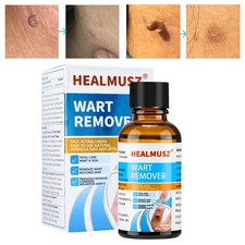 Wart Remover Liquid,Fast Acting to Remove Common and Plantar Warts for Feet Body