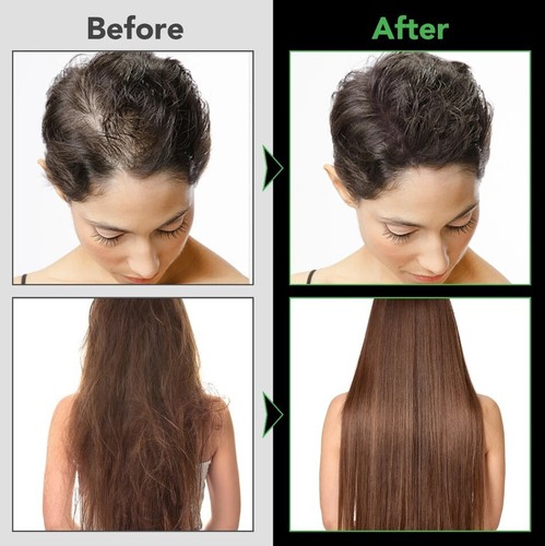 Jamaican Black Castor Oil Conditioner for Hair Growth Strengthen Hair and Scalp - Picture 9 of 19