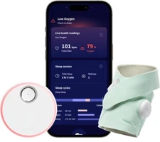 Owlet Dream Sock® - FDA-Cleared Smart Baby Monitor - Track Live Pulse (Heart)...