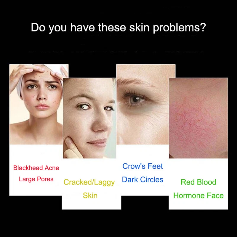 7Color LED Light Photon Face Mask Rejuvenation Facial Therapy Anti-Aging Machine - Image 4 of 4